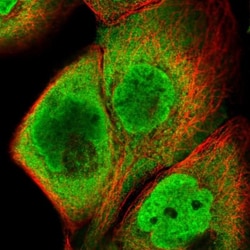 HIST1H2BC Antibody, Novus Biologicals 0.1mL; Unlabeled:Antibodies, Polyclonal